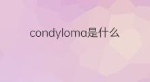 condyloma是什么意思 condyloma的中文翻译、读音、例句